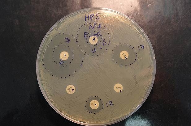 Выращивание отдельных кишечных микробов показывает, что после приема антибиотиков начинают преобладать микробы с более широким спектром устойчивости 
