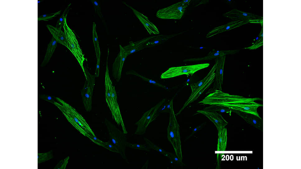 Миофибробласты – клетки, отвечающие за ранозаживление и участвующие в формировании рубца. В культуре эти клетки отличает высокое содержание белков цитоскелета — на снимке они визуализированы зеленым красителем. Благодаря этому миофибробласты способны стягивать края раны, уменьшая ее площадь и ускоряя заживление. Однако эти же клетки являются и основным источником коллагенов и других белков соединительной ткани, которые формируют рубец. Формирование рубца и фиброз необходимы для заживления у человека, так как это способ поддержания целостности органа. Однако оборотной стороной этого процесса является потеря органом своей функции — на месте рубца не могут прорасти сосуды, нервы или нативные клетки.