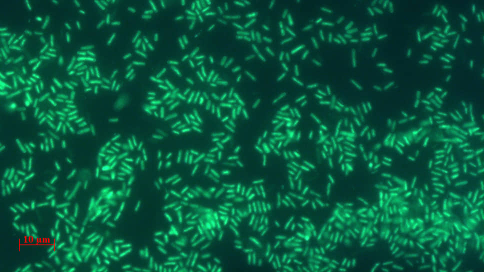 Автофлуоресценция клеток цианобактерий под микроскопом