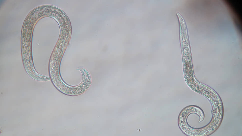 Нематоды под микроскопом