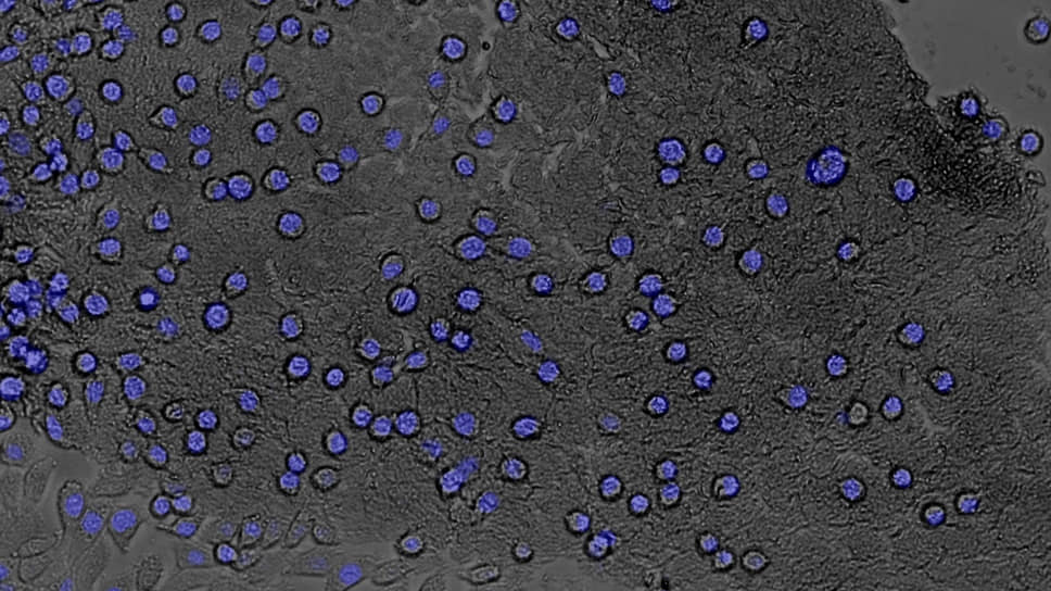 ВКМ мозга с растущими на нем клетками (синим красителем окрашены клеточные ядра)