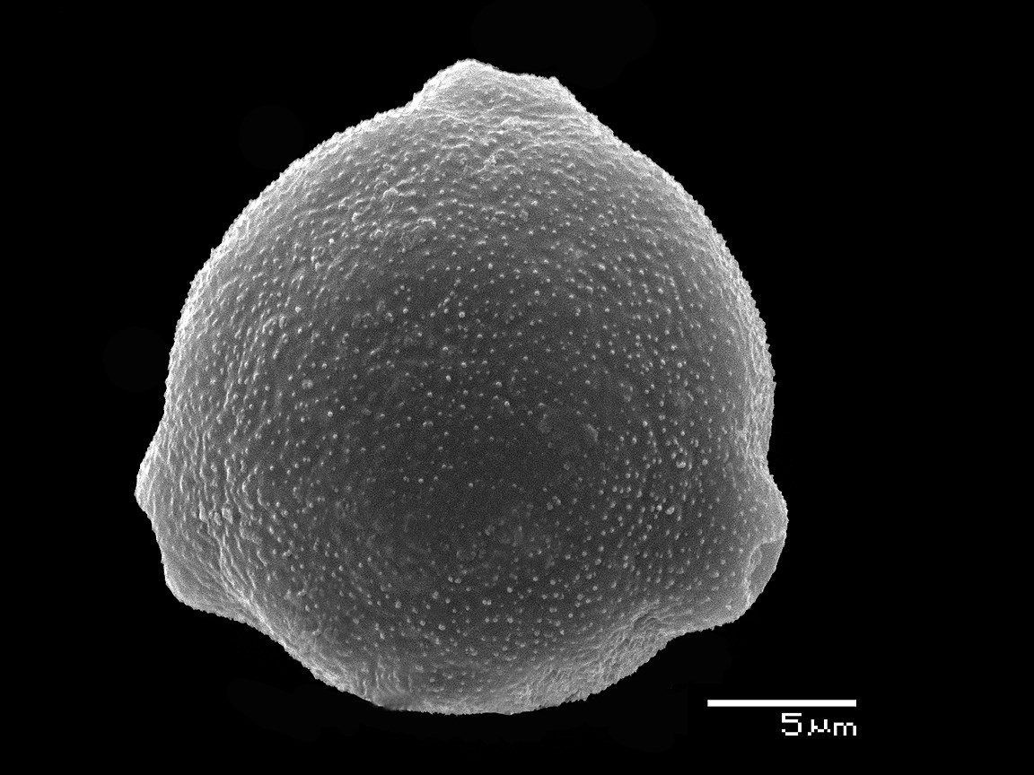 Аллергофон. Пыльца сосны под микроскопом. Пыльца березы микроскопом. Березовая пыльца под микроскопом. Пыльца сосны под микроскопом с подписями.