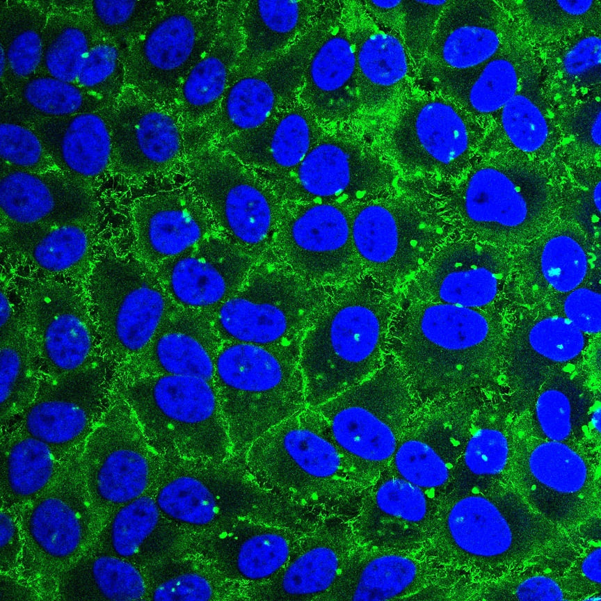 Монослой раковых клеток, выделенных из эпителия шейки матки