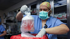 Ксенотрансплантация дает два месяца жизни