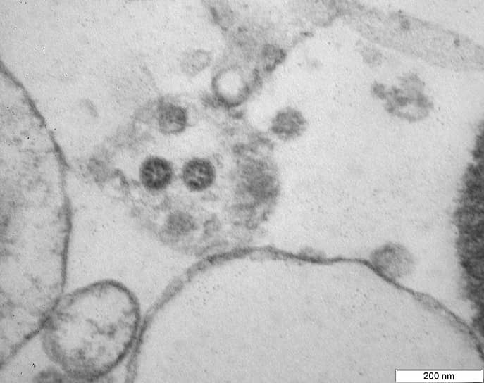 Вирусные частицы коронавируса (омикрон-штамм)