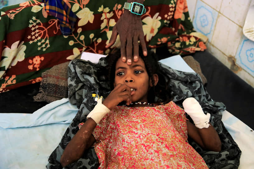 Лечение девочки после потери руки из-за взрывчатки, оставленной возле ее дома в результате конфликта в Эфиопии, февраль 2022 года 