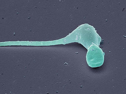 Зарождение сперматозоидов в тестикулах. В последние годы среди этой армии встречается все больше увечных «бойцов» с деформированными жгутиками и ядрами