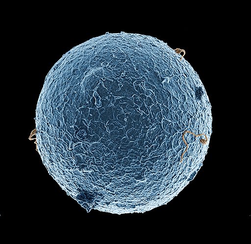 С каждым годом миссия оплодотворения яйцеклетки становится все менее выполнимой для среднестатистического человеческого сперматозоида