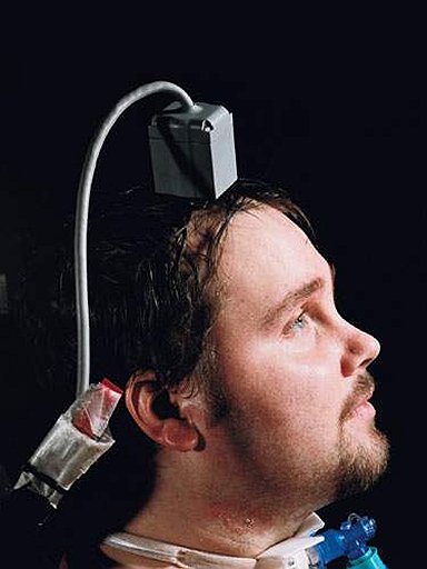 Самый старый носитель чудо-чипа, который переводит сигналы мозга на язык компьютера, 25-летний американец Мэттью Нейгл