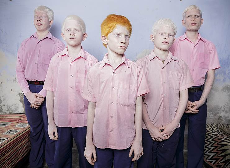 Брент Стертон, Южная Африка, Reportage by Getty Images. Слепые школьники-альбиносы в Миссионерской школе Вивекананды  
