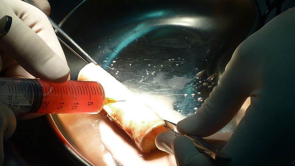 Операция по пересадке искусственного органа занимает 7-10 часов. На фото — подготовка к пересадке трахеи 
