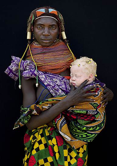 Проделки генетики: белокожий ребенок-альбинос на руках темнокожей матери. Современная наука не знает точно, как работают гены, и это лишний повод быть сверхосторожным, когда с их помощью объясняют различия между расами и классами