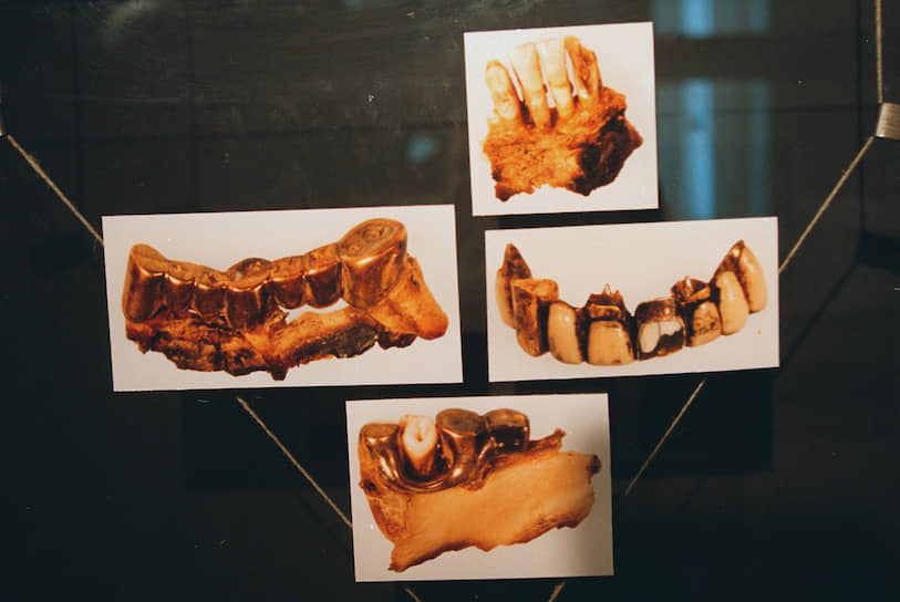 Фрагменты челюстей и зубов Адольфа Гитлера были показаны на выставке «Агония Третьего рейха: Возмездие» в 2000 году