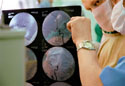 Снимки сосудов мозга помогают врачу во время операции