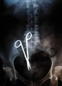 Рентгеновский снимок: замечательно видно, что внутри пациента кто-то что-то забыл