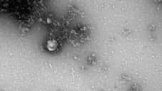 Ученые новосибирского центра «Вектор» впервые в мире сфотографировали «британский» штамм коронавируса