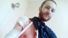 Журналиста «Медиазоны» оштрафовали за неповиновение полицейскому, сломавшему ему руку