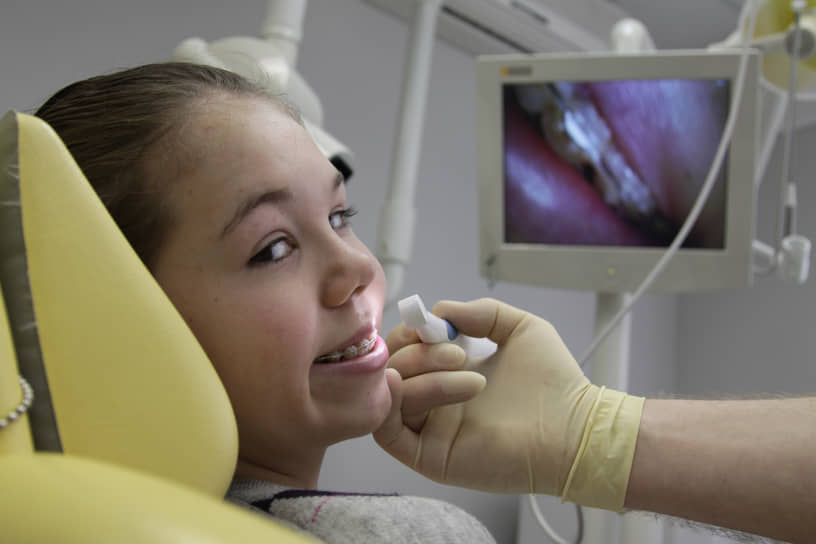Ортодонтическое лечение вышло за рамки детской стоматологии: среди взрослых установка брекетов сегодня является одной из самых востребованных услуг