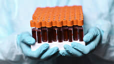 Еще 74 жителя Курской области сдали положительные тесты на новый коронавирус