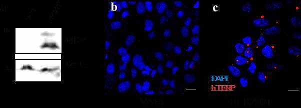 Рис. 1. Доказательство наличия белка hTERP в клетках, содержащих теломеразную РНК методами иммуноблоттинга и флуоресцентной микроскопии. Красным показан белок hTERP, синим — ядра клеток