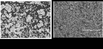 Рис. 2. Микрофотография клеток дикого типа и клеток с повышенным содержанием hTERP после обработки ДНК-повреждающим веществом