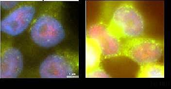 Рис. 3. Анализ методом флуоресцентной микроскопии позволил выявить нарушения в развитии аутофагии в клетках, содержащих мутантный hTERP. Зеленым окрашен маркер развития аутофагии