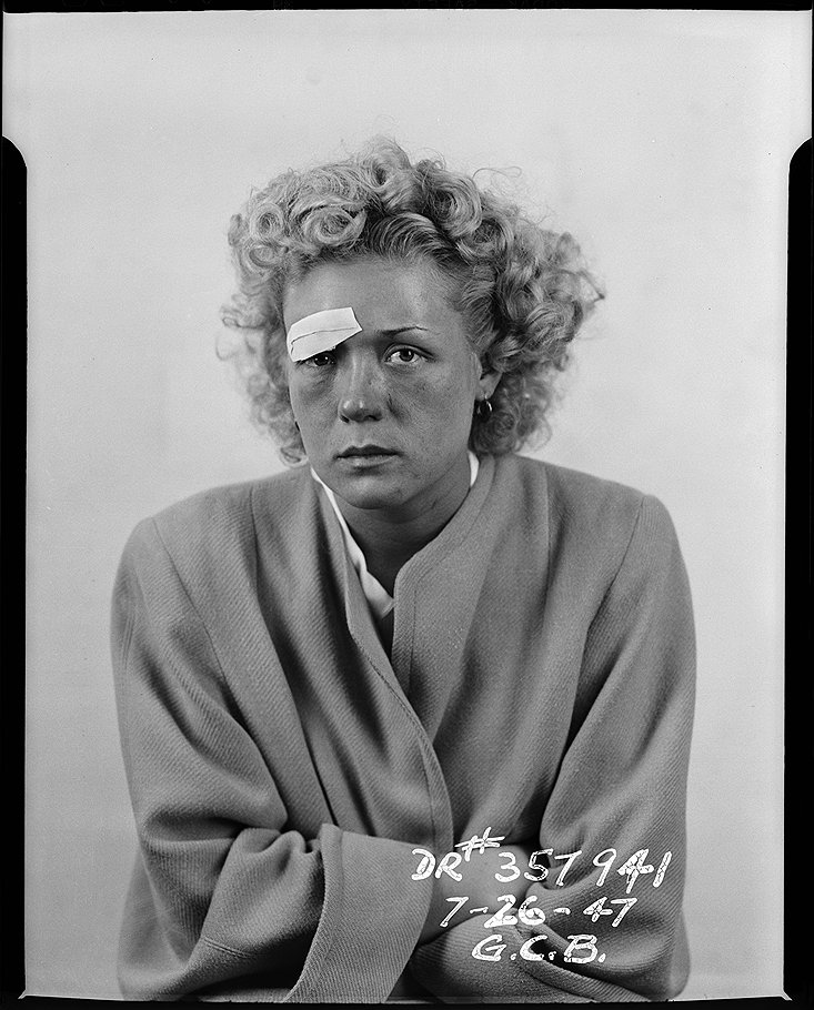 Женщина в пальто со сложенными руками. Вид спереди. Правая бровь заклеена пластырем. 1947 год. Фотограф: Бэббит 

