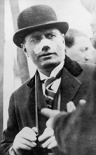 Бенито Муссолини после покушения на него, совершенного Виолеттой Гибсон 7 апреля 1926 года 